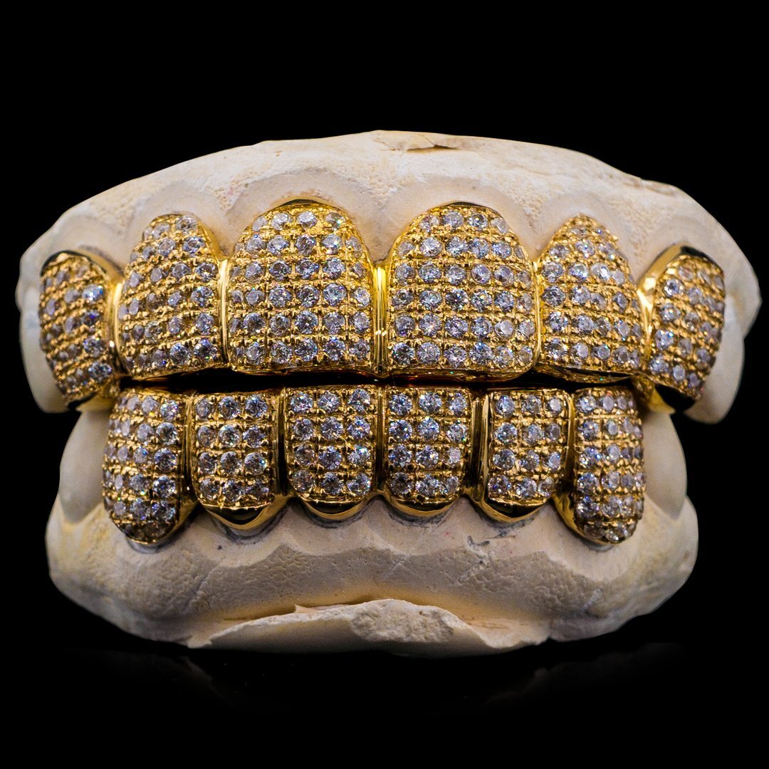 10k vs 14k vs 18k vs 24k gold for Grillz [All You Need To Know]