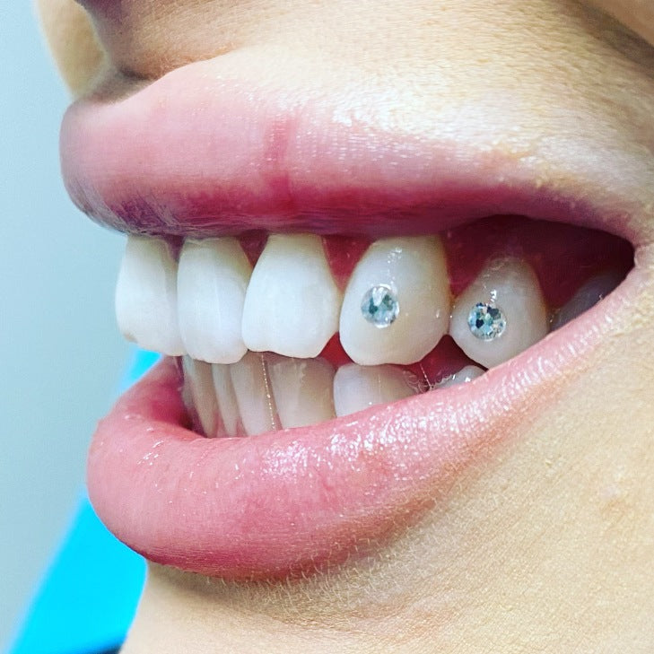 Want a Permanent Diamond on Your Tooth? [Everything You need to Know A