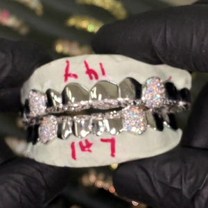 Diamond Cut & Diamond Dust Tips with Iced Fangs Grillz