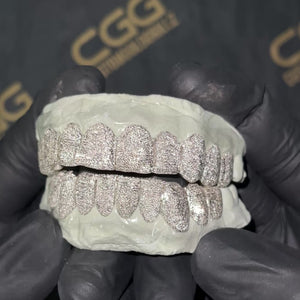 Solid .925 Sterling Silver Diamond Dust Grillz