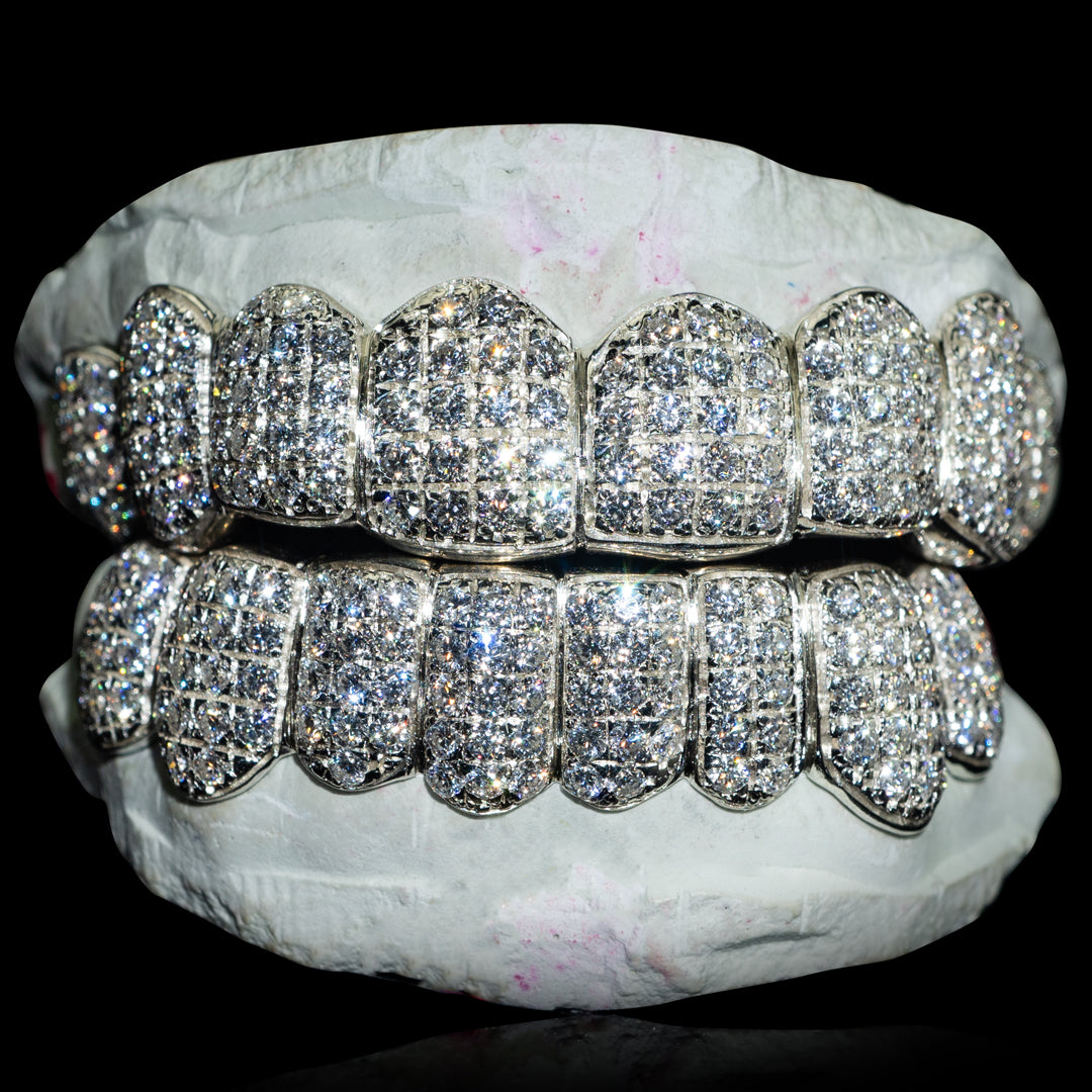 Custom Fully Iced Out VVS Moissanite Grillz (Straight) - Custom Gold Grillz